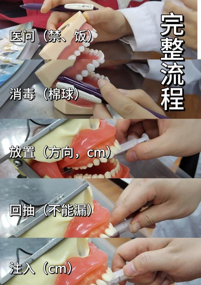 口腔执医技能备考攻略（从基础知识到临床实践，打造口腔执医高手）-第2张图片-游技攻略库